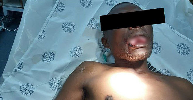 ধর্ষকের জিহ্বা কামড়ে ছিড়লেন নারী চিকিৎসক